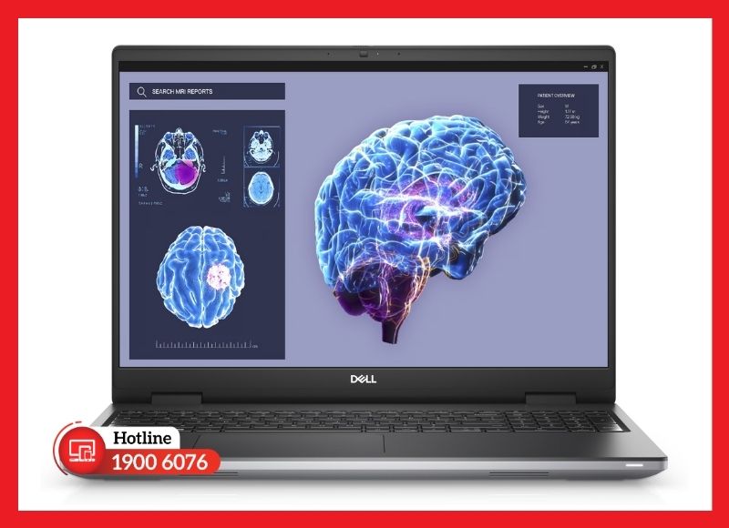Kỹ thuật viên cần đo đạc và xác định chính xác mã màn 16 inch trước khi tháo lắp